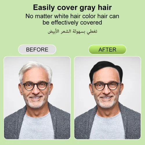 Premium Green Apple Ammonia-Free Black Hair Oil - 100% Gray Coverage & Non-Stick Formula (430ml)