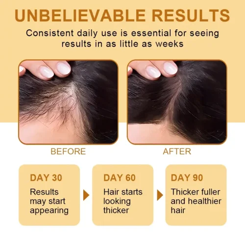 Meidu 100% Raw & Organic Batana Oil - Deep Nourishing Hair Mask & Scalp Treatment